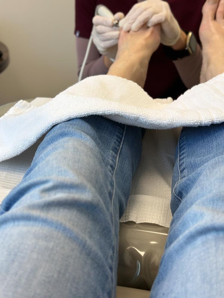 jambes en jean pieds nus chez le podiatre, technicienne mains gantés qui travaille sur les orteils
